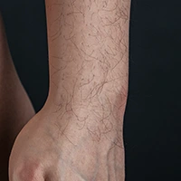 Arm hair