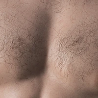 Chest hair