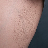 Leg hair