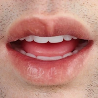 Soft silicone head (Moveable jaw)