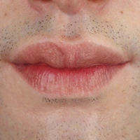 Hard silicone head (Default)